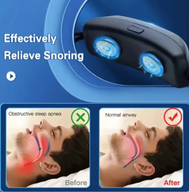 BreatheMax™ Anti-Snoring Device